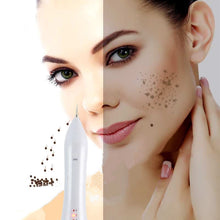 SpotEraser™ - Remove Tag/Mole/Tattoo on Skin